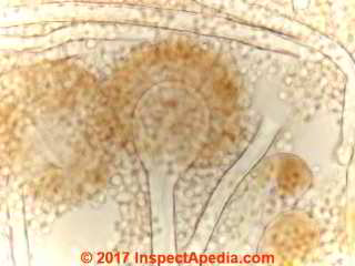 Aspergillus versicolor-like mold under the microscope (C) Deniel Friedman